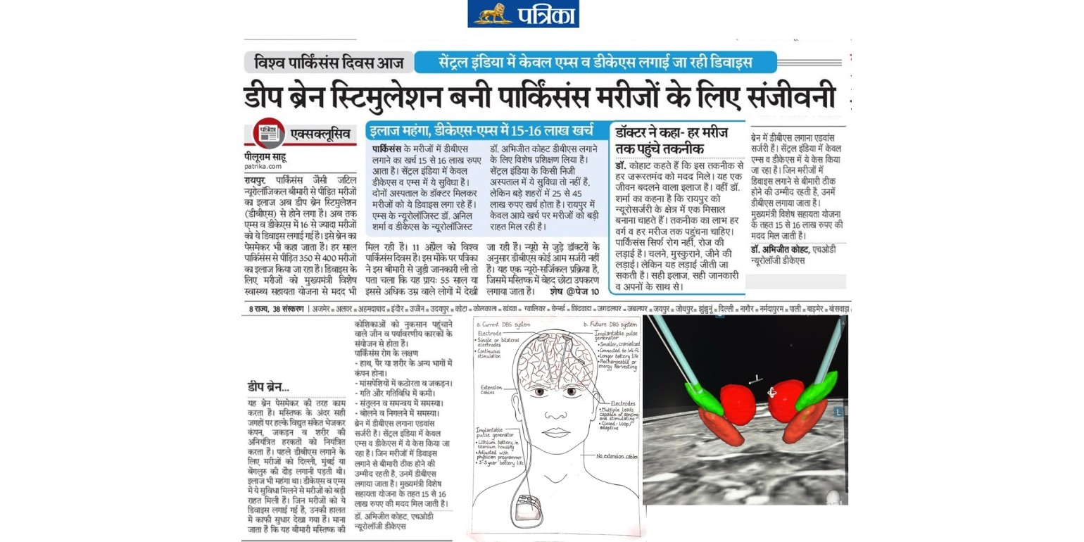 Deep Brain Stimulation Surgery